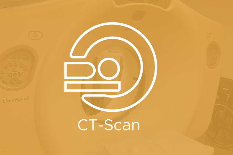 ct scan