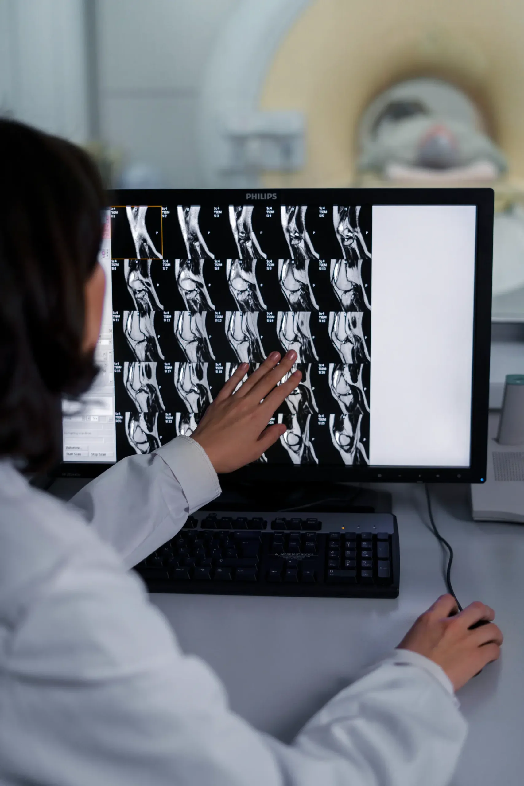 doctor-looking-ct-scan